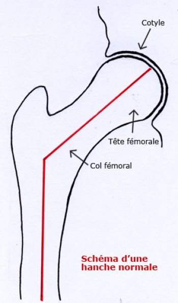 Schéma d'une hanche normale